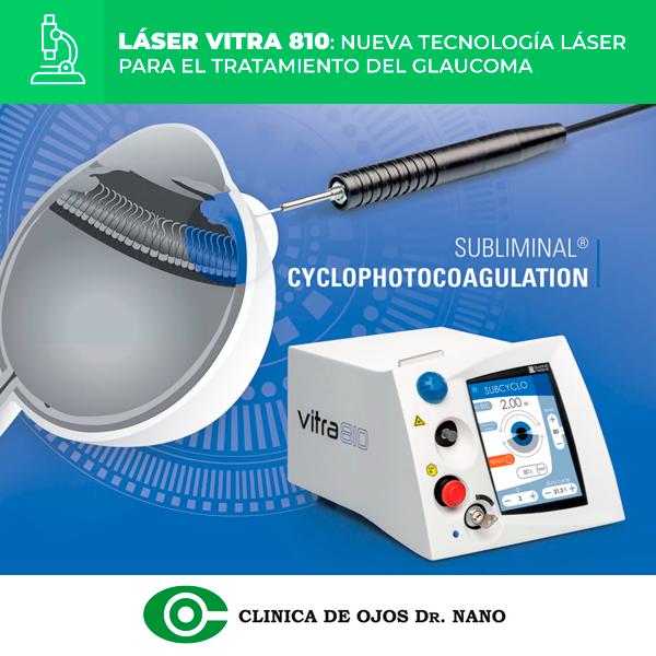 Es una gran noticia anunciar que incorporamos el Láser Vitra 810, que permite realizar un procedimiento mínimamente invasivo de última generación, para bajar la Presión intraocular!